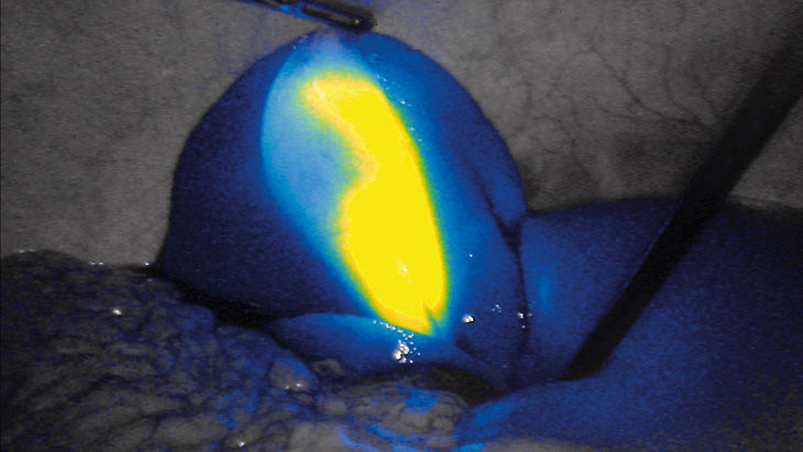 FI-Intensität – 3D-Fluoreszenz-Bildgebungstechnologie