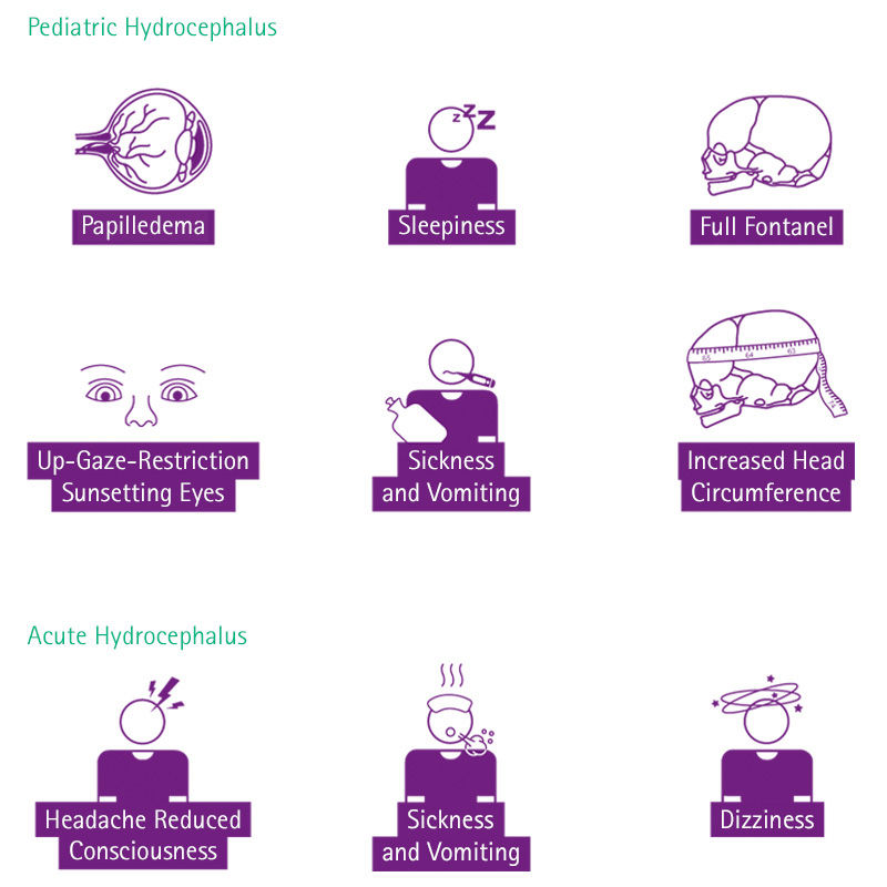 Symbole für die Symptome des pädiatrischen und akuten Hydrozephalus