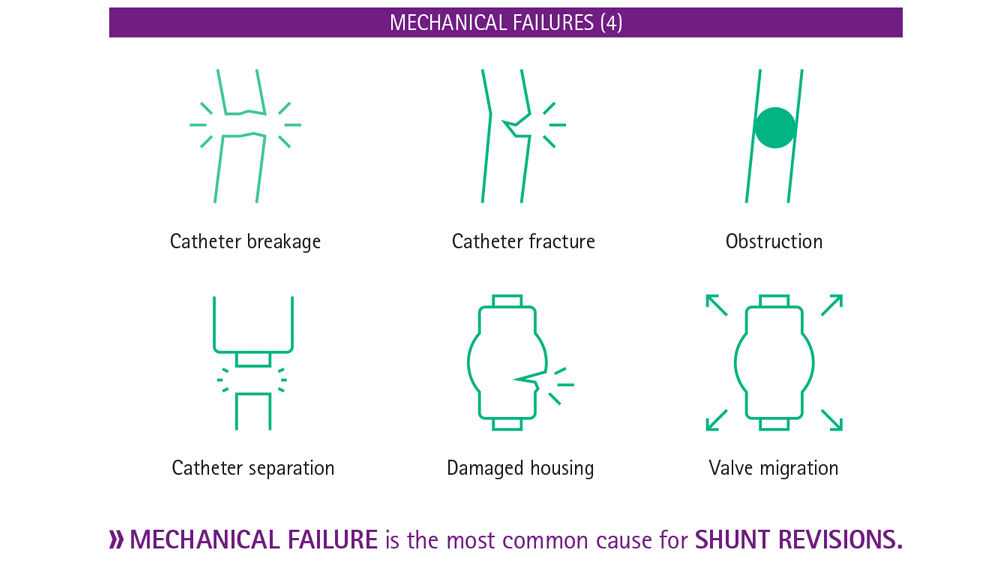 Infografik Hydrocephalus-Shunts mechanische Fehler