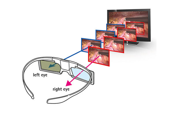 Beispiel 3D-Brille mit Aktiv-Shutter