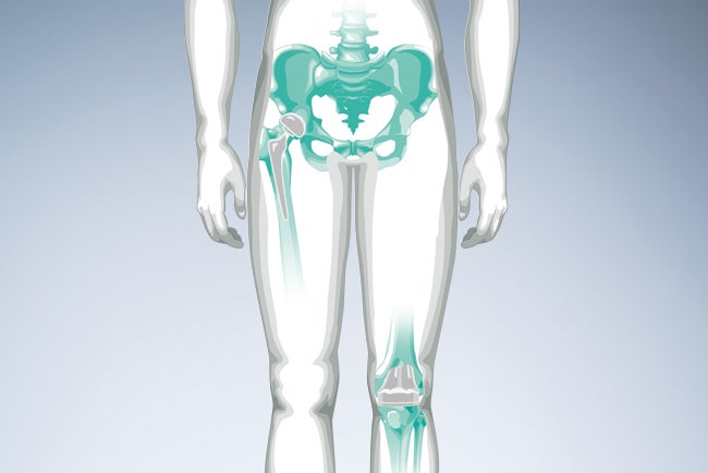 Orthopädischer Gelenkersatz und regenerative Therapien