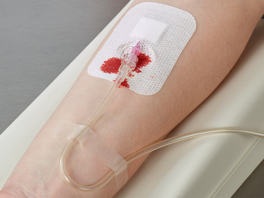 Verschüttetes Blut auf IV-Verband