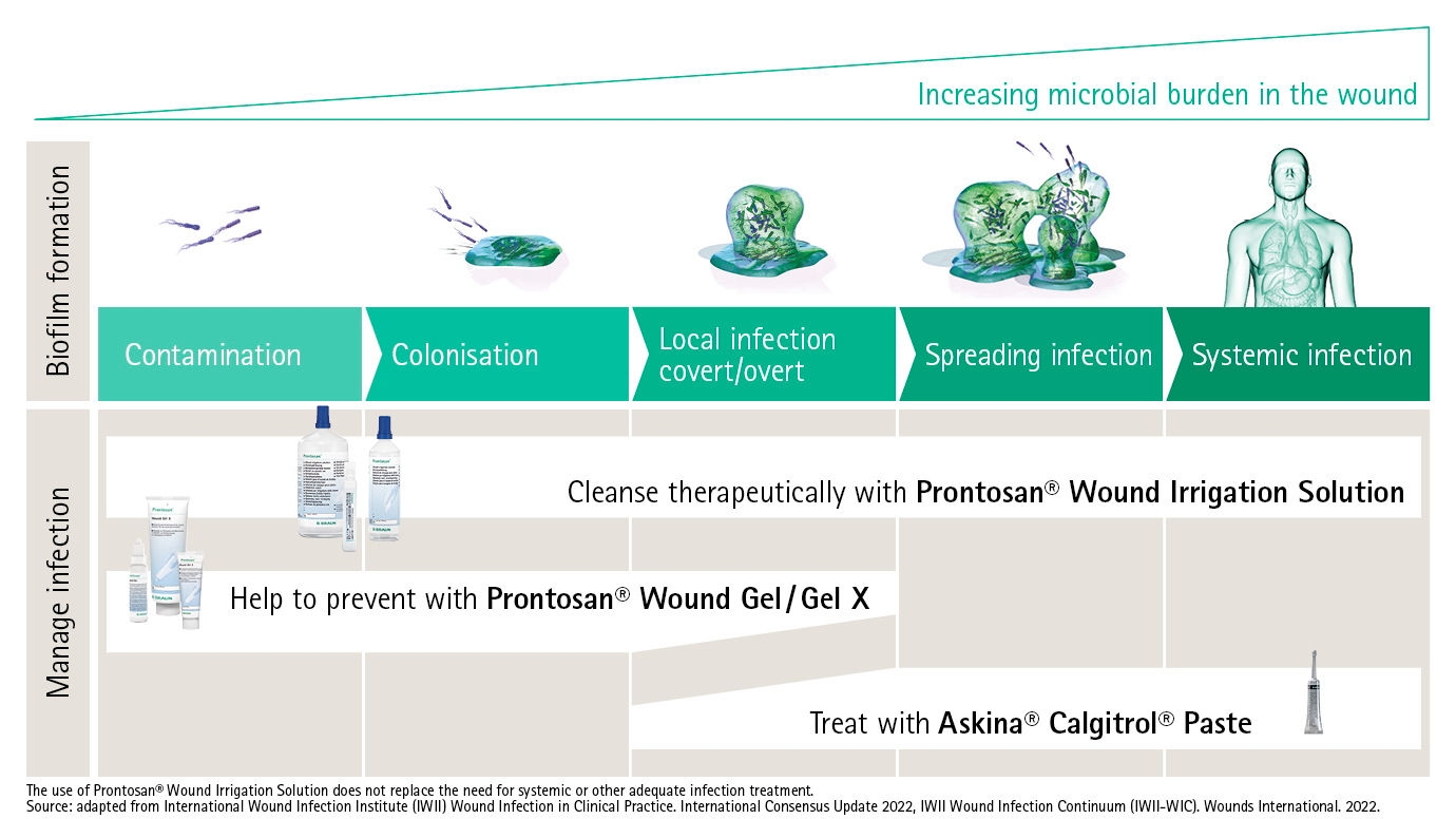 wound infection continuum