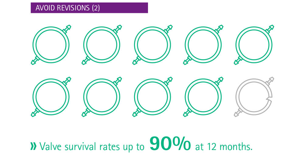 Infografik Vermeidung von Revisionen
