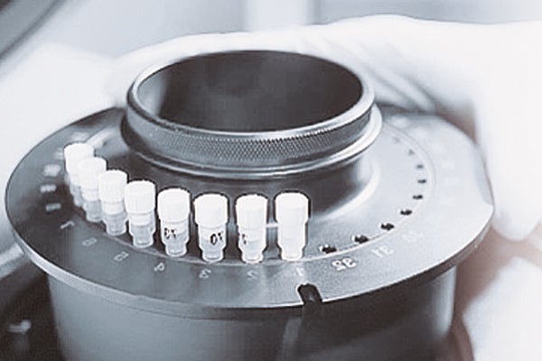 Herstellung des Knorpelzelltransplantates
