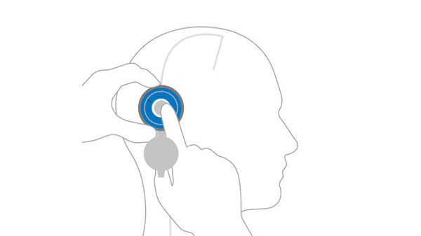 Abbildung Einstellung M.blue plus®