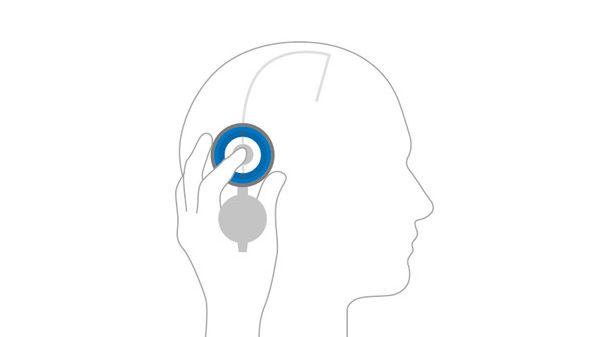 Abbildung der Lokalisierung von M.blue plus®