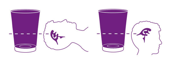 Symbol für negativen Ventrikeldruck in aufrechter Position