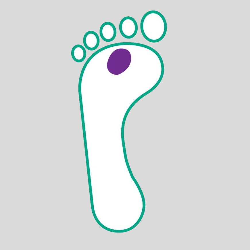 diabetisches Fußgeschwür Illustration Grad 2